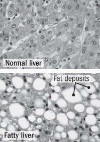 Liver Cells