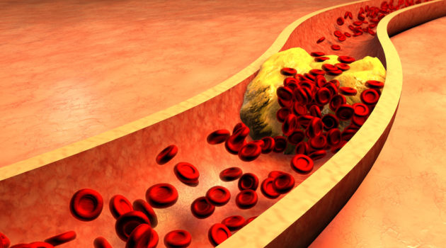 arteries