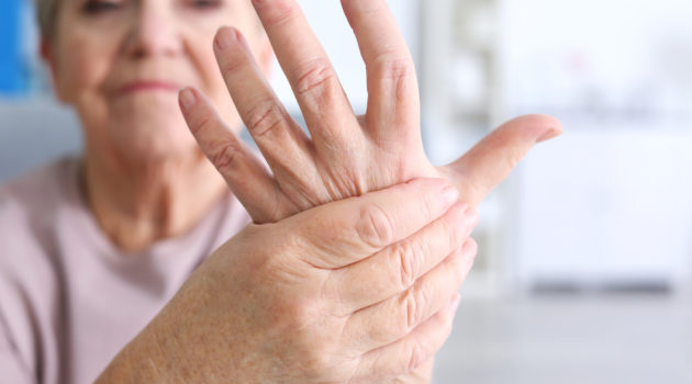 arthritis