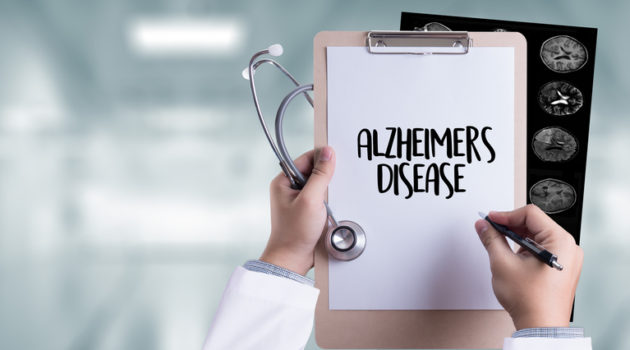 alzheimers