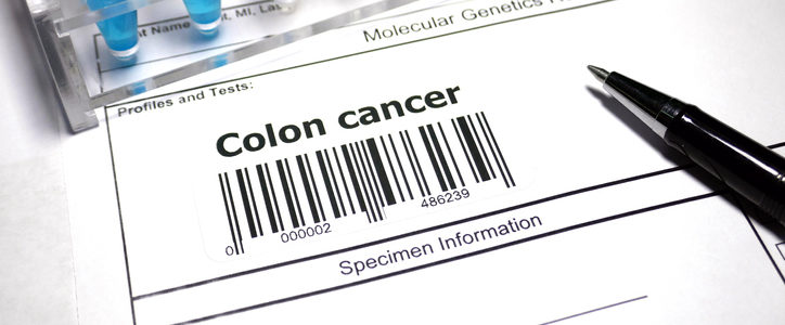 colon cancer