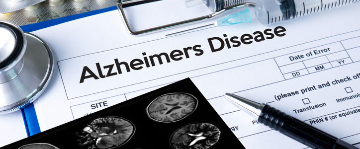brain scan Alzheimers disease