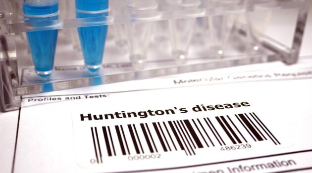 Huntington's Disease