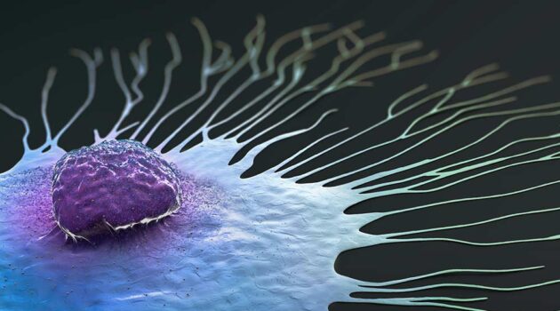 Scientific illustration of a migrating breast cancer cell .